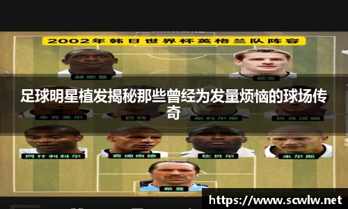 足球明星植发揭秘那些曾经为发量烦恼的球场传奇